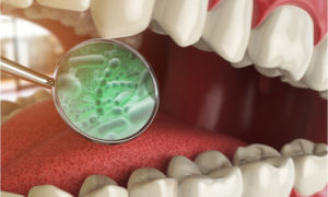 bacteria in teeth