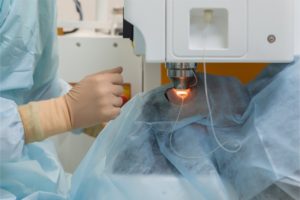 removing cataract through laser surgery