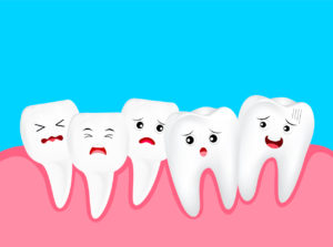 Causes And Treatment For Crowded Teeth